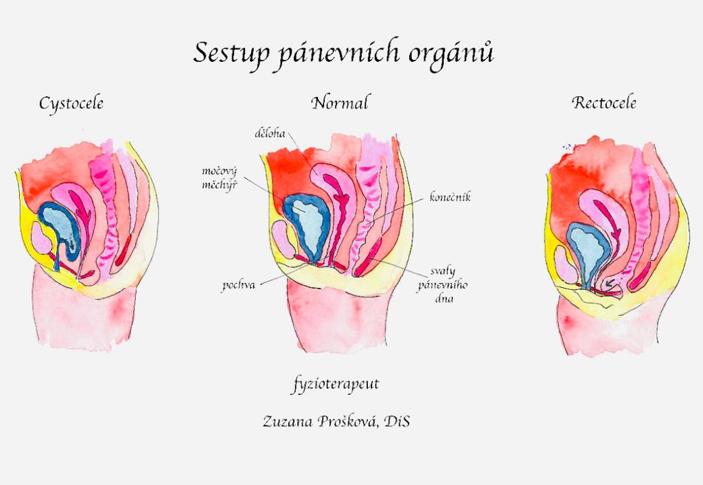 Diagnostika pánevního dna